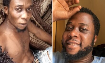 Man Shares Massive Transformation After Two Years Of Quitting His Drug Addiction.
